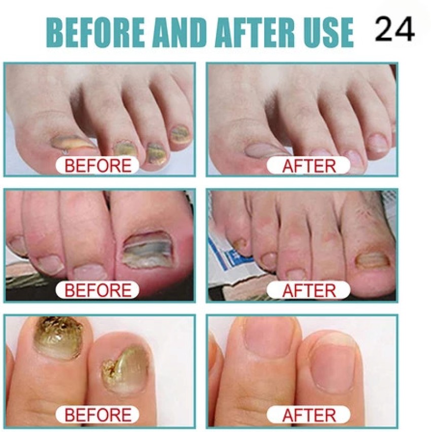 How To Grow Nails Faster In 18 Easy Steps | YourTango