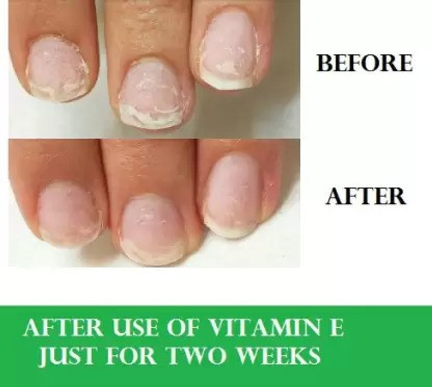 Nutriburst Biotin Gummies for Healthy Hair, Glowing Skin & Nails Growth  (Sugar-free) Price in India - Buy Nutriburst Biotin Gummies for Healthy  Hair, Glowing Skin & Nails Growth (Sugar-free) online at Flipkart.com