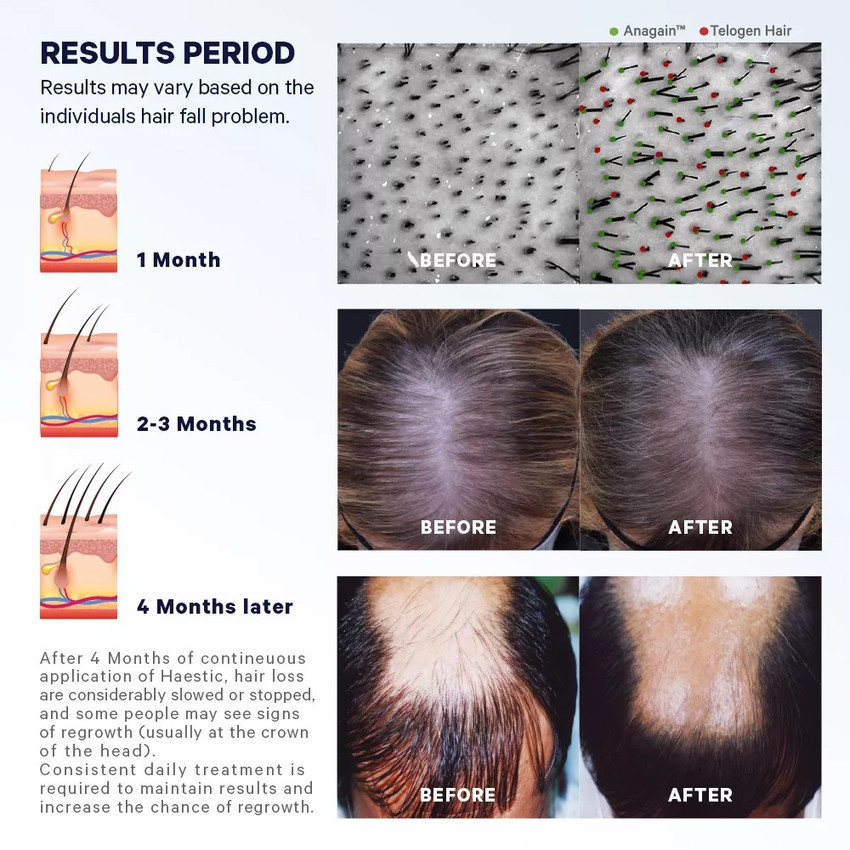 Discover 161+ hair care falling tablet super hot camera.edu.vn