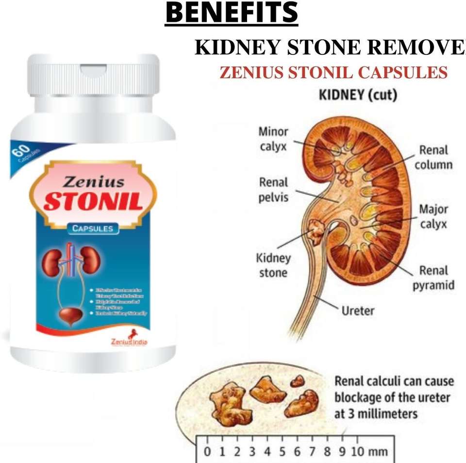Stone Capsule Zenius Stonil Capsule for Kidney Stone Medicine 100% Ayurvedic Price in ...