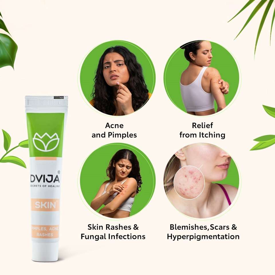 DVIJA Skin Cream - Acne, Pimples, Rashes, Scars, Insect Bites & Fungal ...
