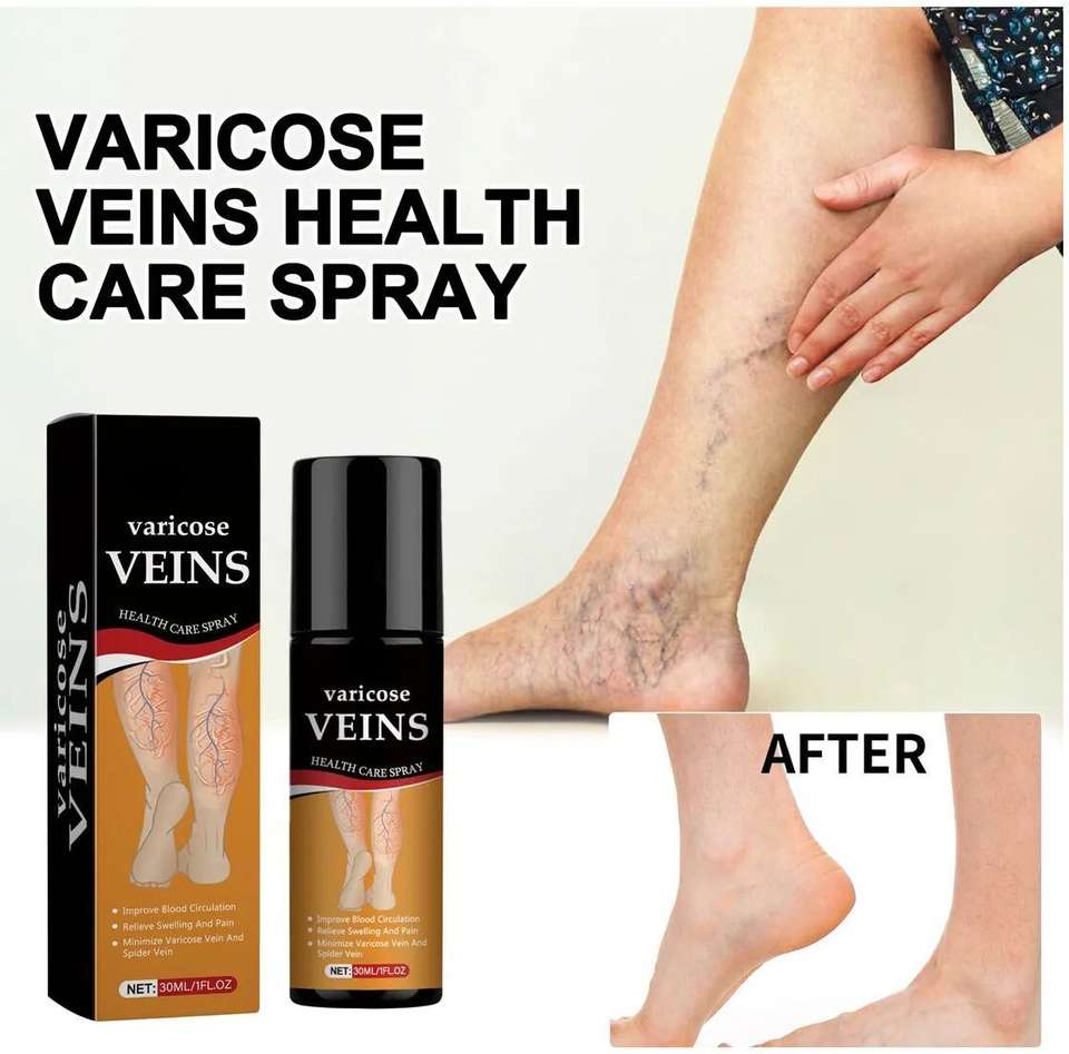 LORSHEL Varicose Vein Spray For Women - Professional Grade with Daily ...