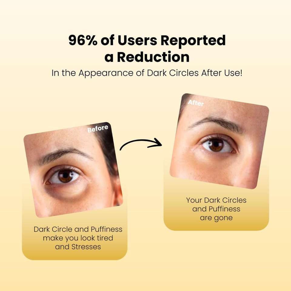 Eyecirque Under Eye Gel Serum for Dark Circles, Puffiness & Fine lines ...