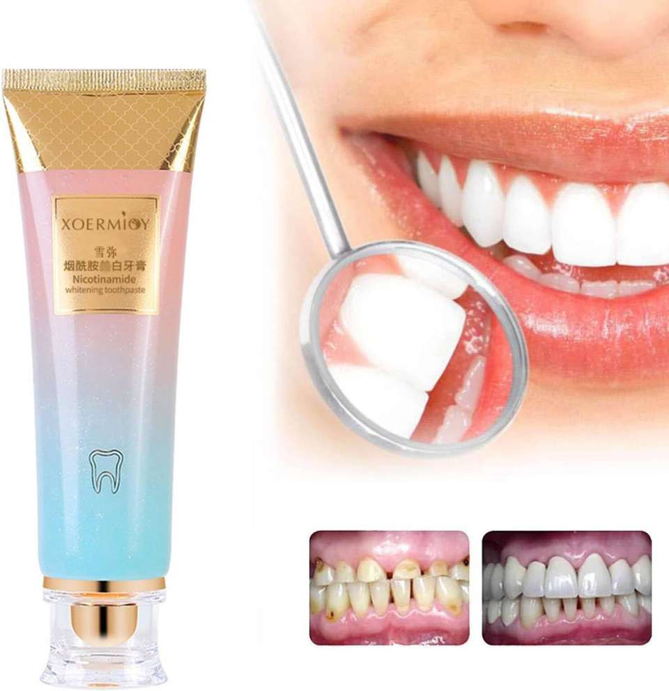 uxoroal Niacinamide Whitening Paste – Gum Comfort Formula Toothpaste ...