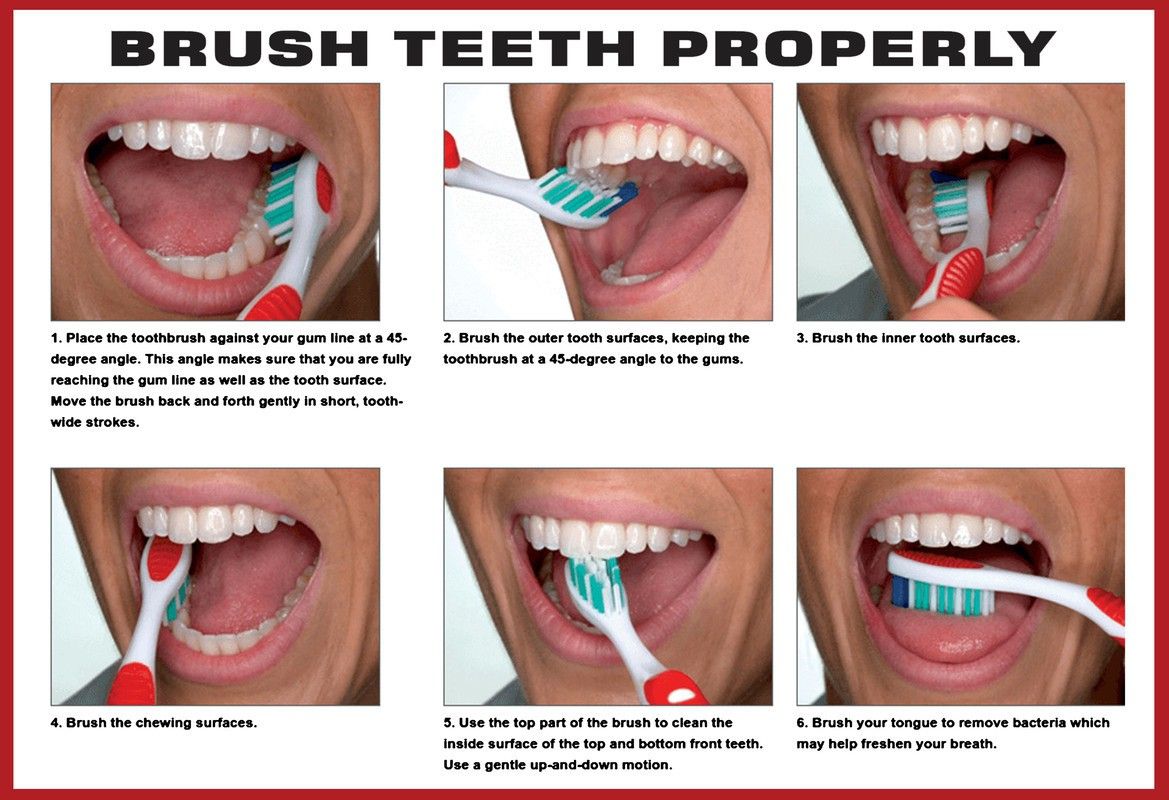 Poster Dental Dentist Brush Teeth Properly Wall Poster (300 Gsm Matte Paper, 13 X 19 Inch, Multicolour) Fine Art Print-image-17
