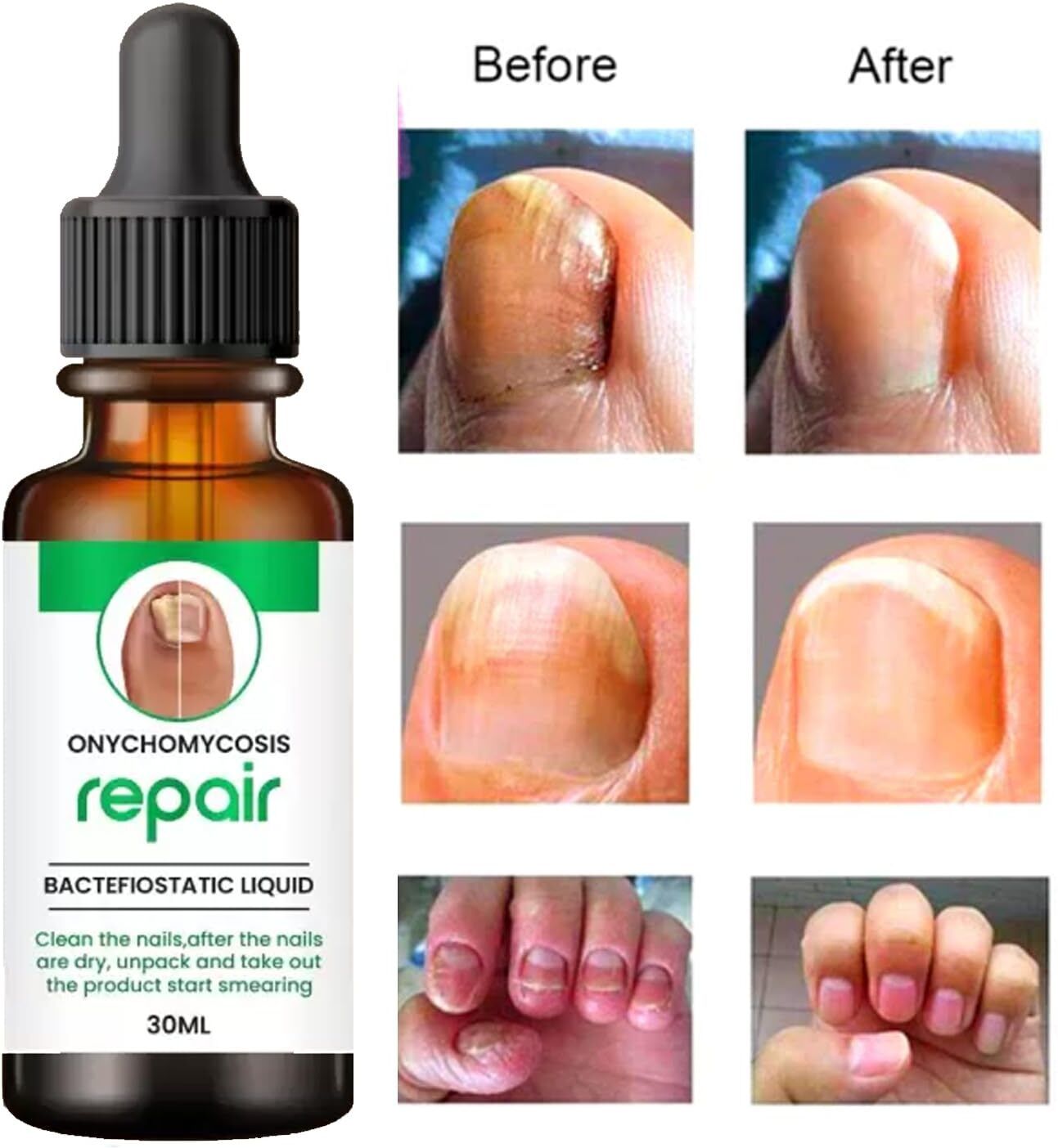pratham Nail Serum Boost Nail Strong & Repair Nails Pack of (30 ml)1 White-picture-34