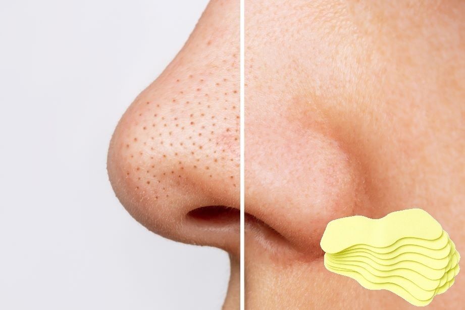 Paper Blackhead Remover Strips-image-28