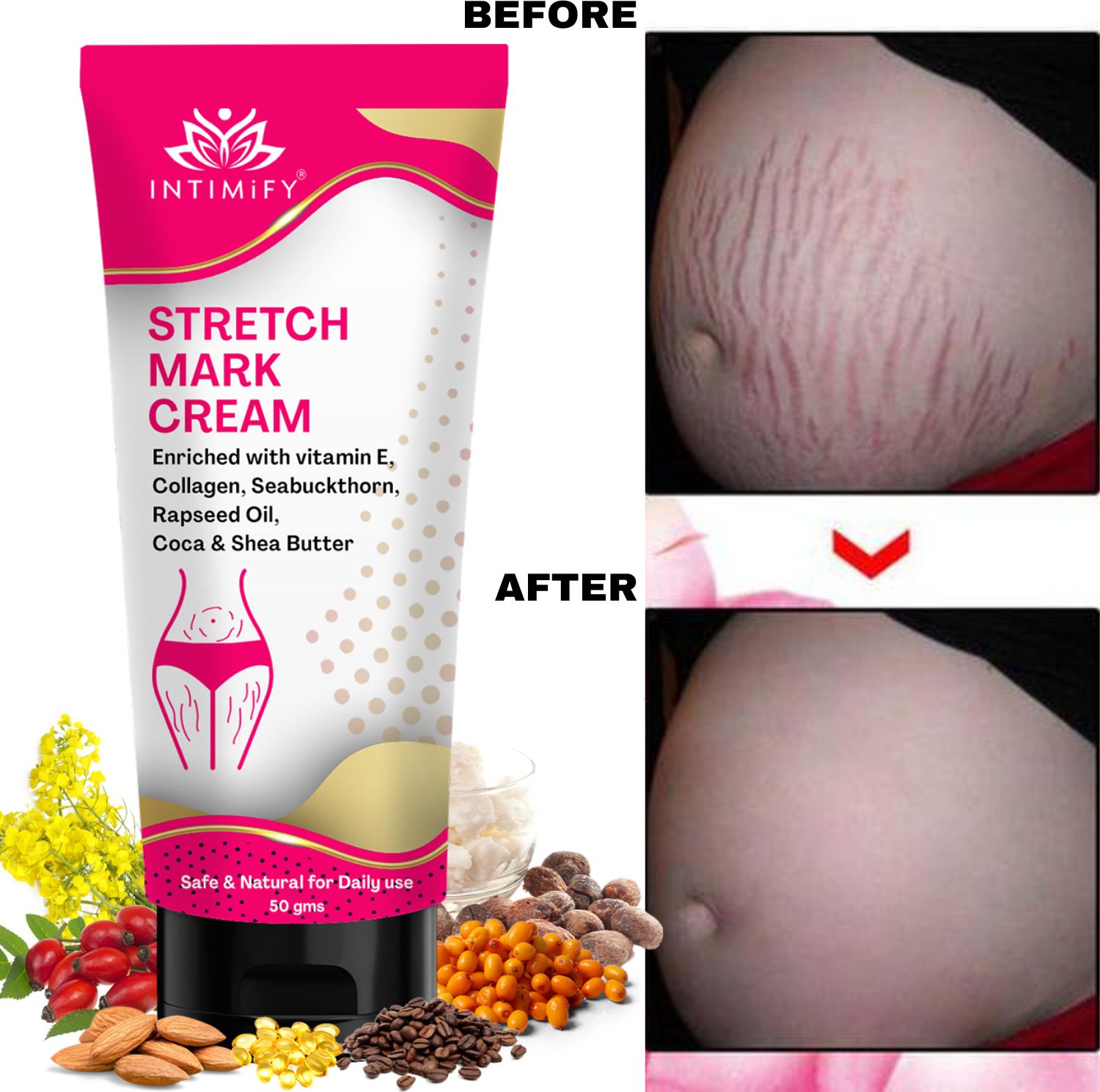 Stretch Mark Cream For Women, Remove Pregnancy stretch marks Intimate Cream-image-29