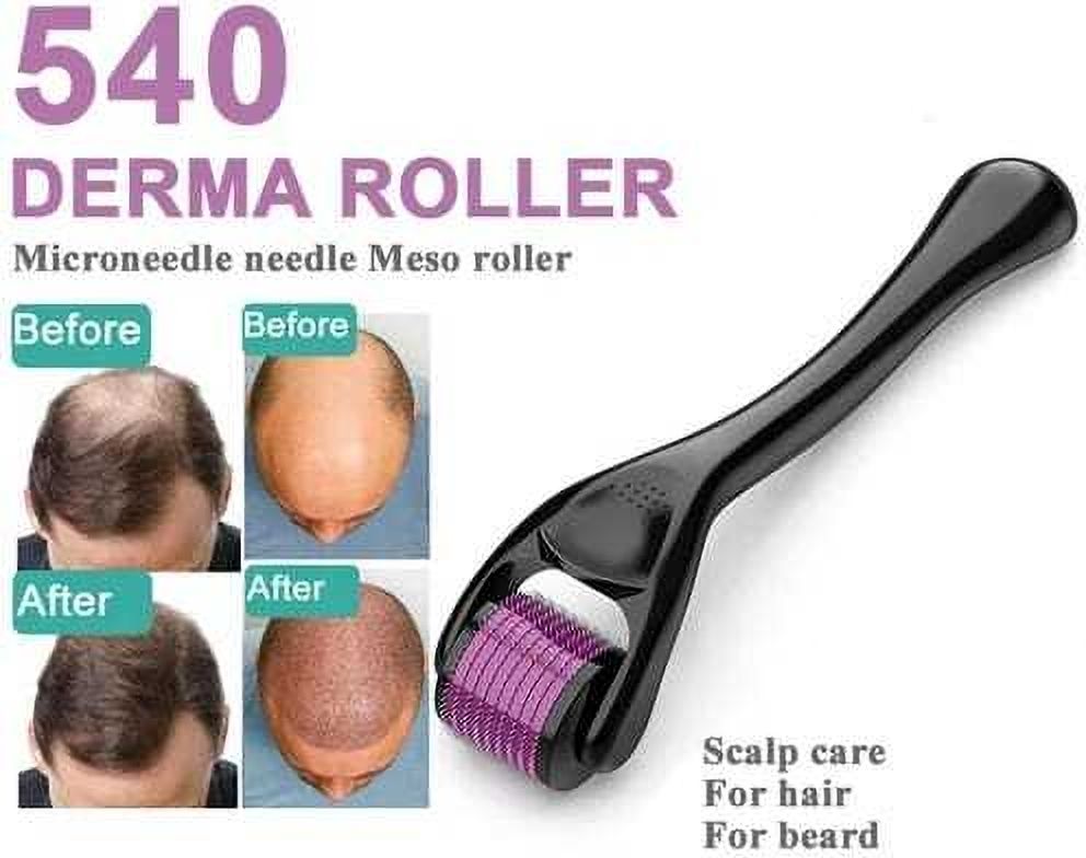 FlyTouch 540 Derma Roller Facial Care Beauty Acne Roller Microneedle Therapy System 540 Derma Roller Facial Care Beauty Acne Roller Microneedle Therapy System Massager-image-33