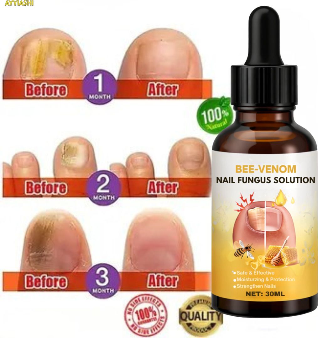 Bee Venom Nail Treatment Serum Toner Supporting Nail Repair