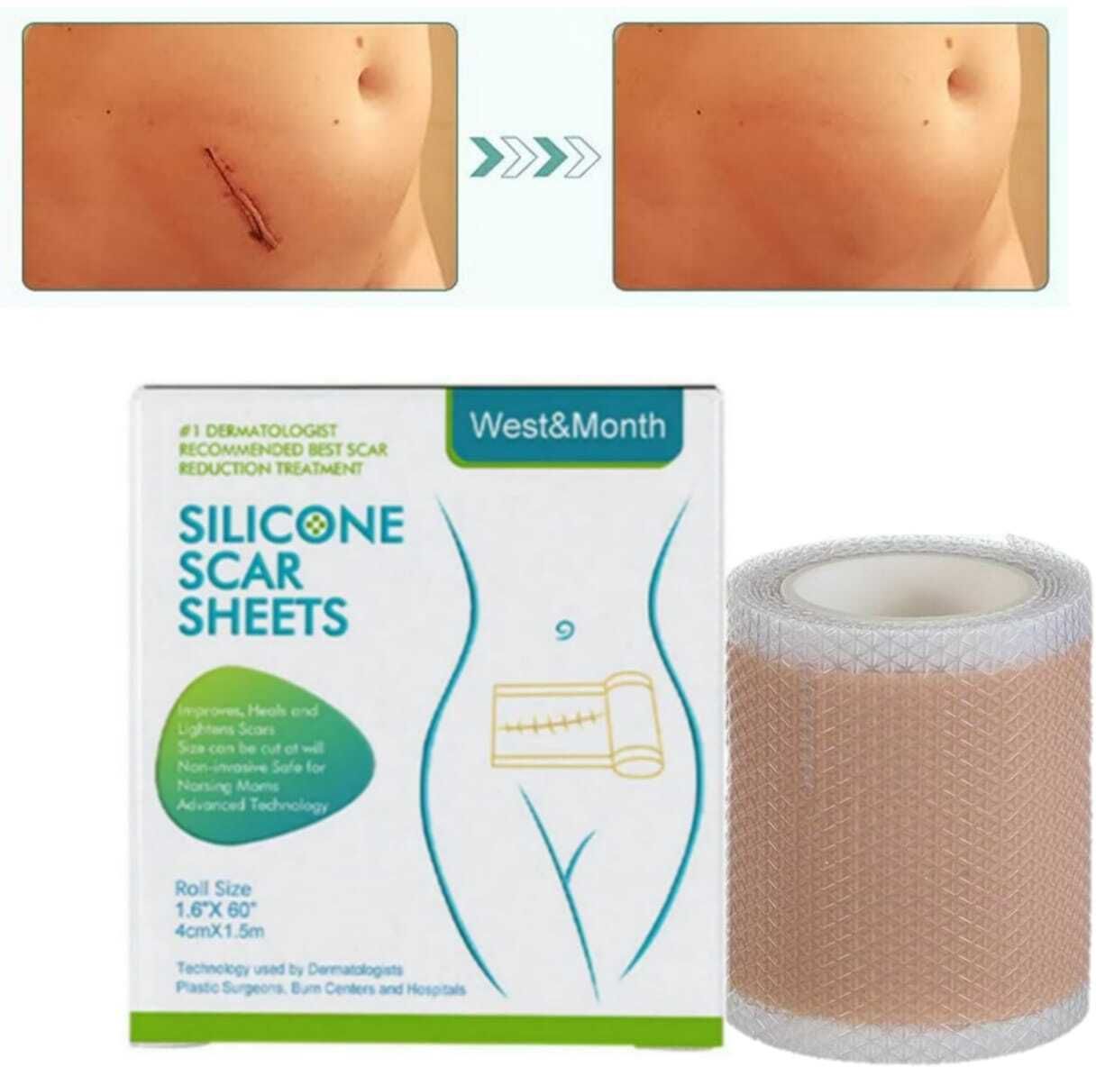 silicon scar Silicone Scar Sheets For Strech MArcks Removal, Tummy Tunk Crepe Bandage-picture-12