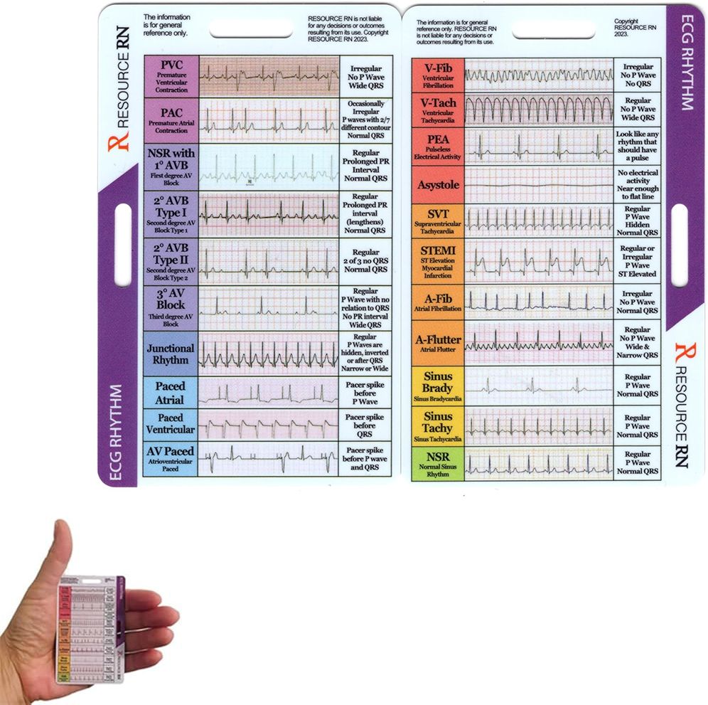 maycreate EKG Rhythm Pocket Card Self Check Guide for Medical Professionals Easy Reference-picture-45
