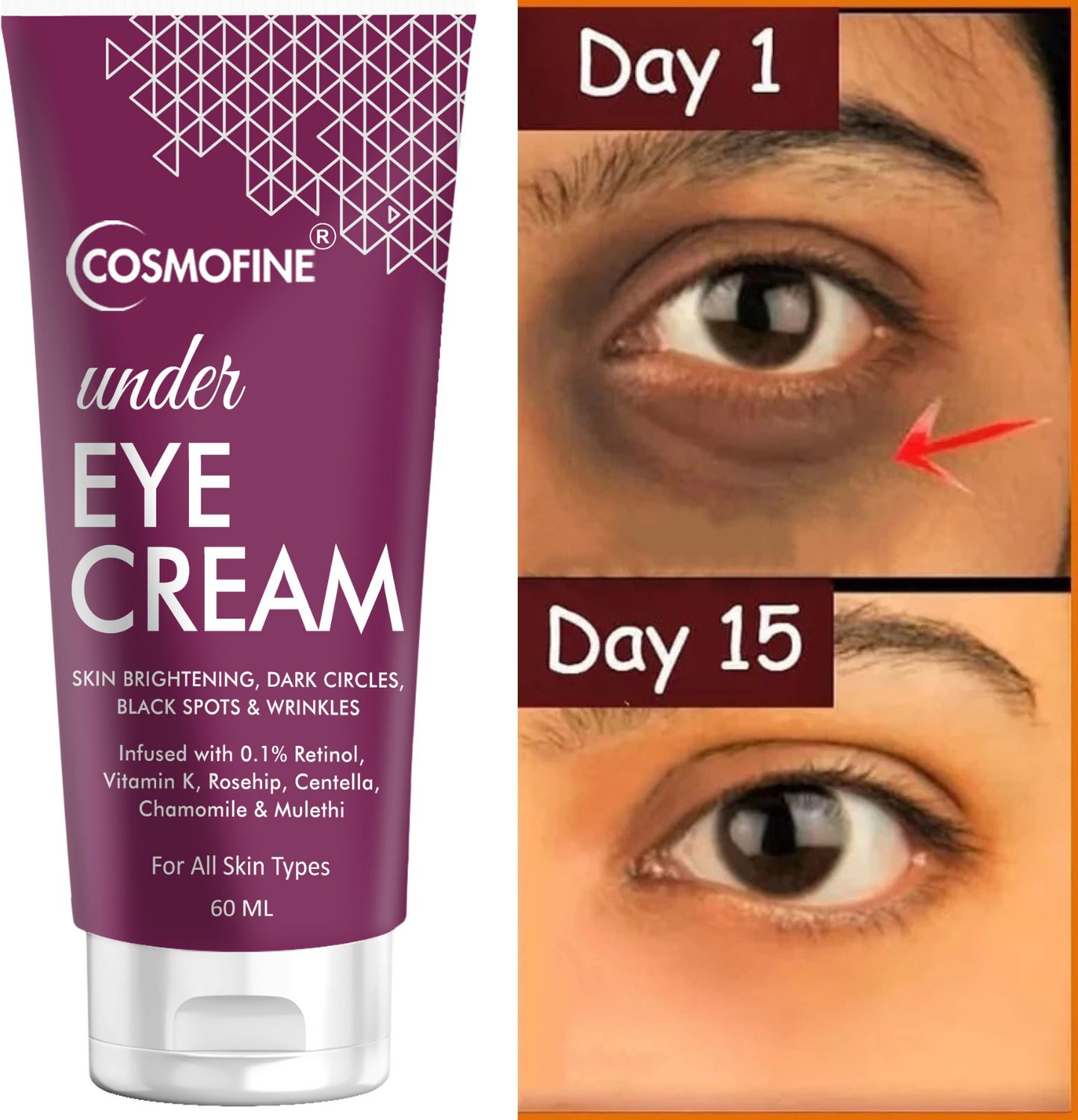 Under Eye Cream For Dark Circles for Women & Men | Fine Lines & Puffy Eyes