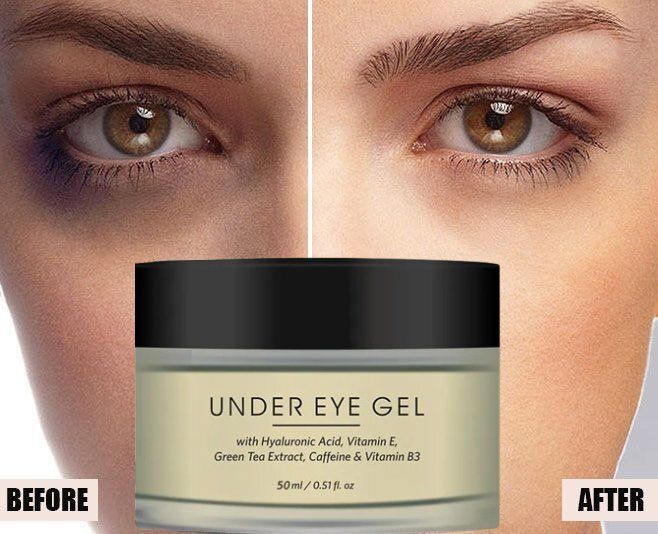 Under Eye Cream Gel for Dark Circles, Puffy Eyes, Wrinkles & RemovalAX81