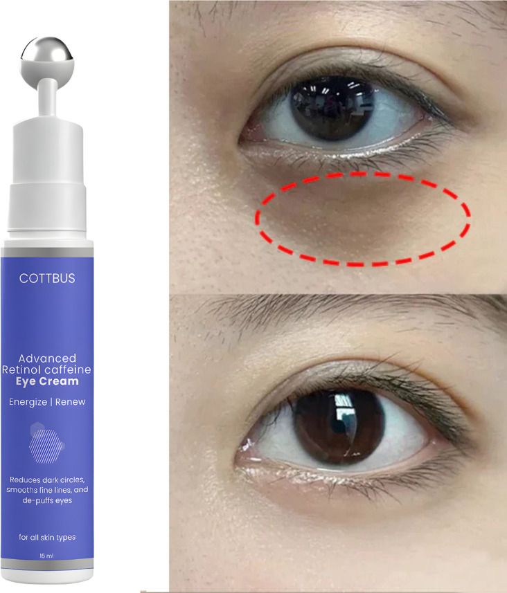 Under Eye Cream for Dark Circle Remover Cream | Wrinkles Removal Cream .-image-8