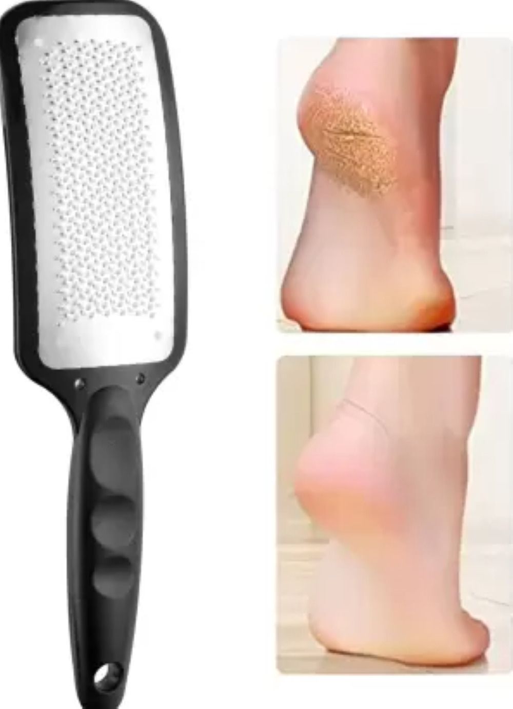 Foot Filer, Foot Scrubber for Dead Skin, Pedicure Tool
