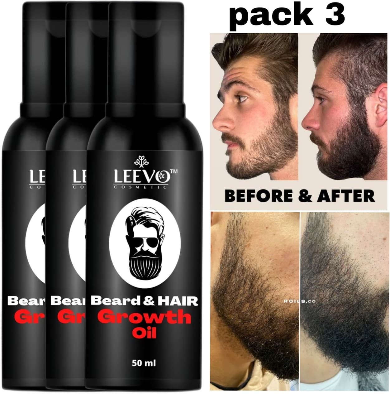 Best Beard Oil for Men for Conditioning, Growth, Dandruff Control & Shine Hair Oil-image-25