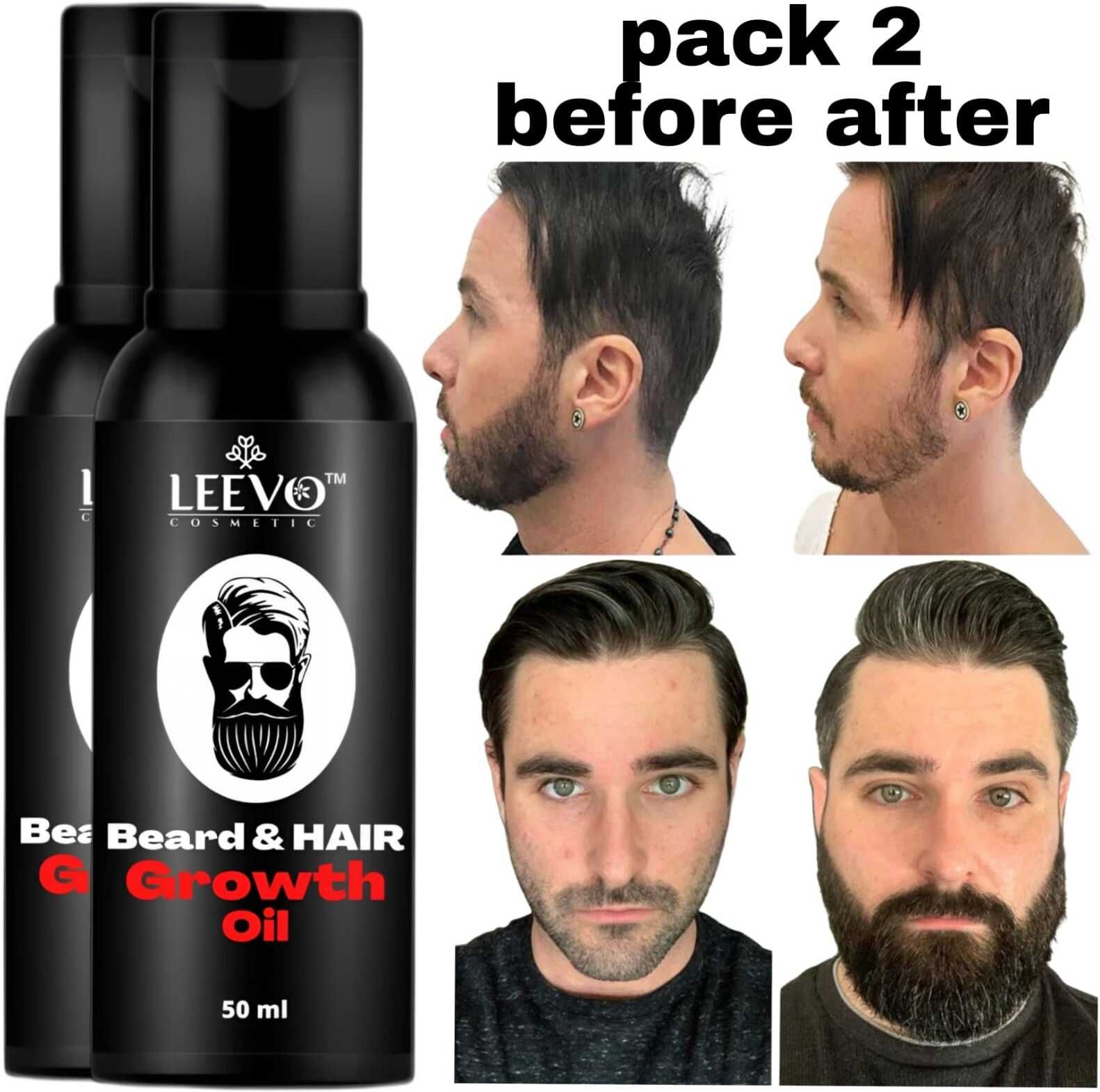 Herbal Beard Oil for Nourished Skin and Healthy Beard Hair Hair Oil-image-34