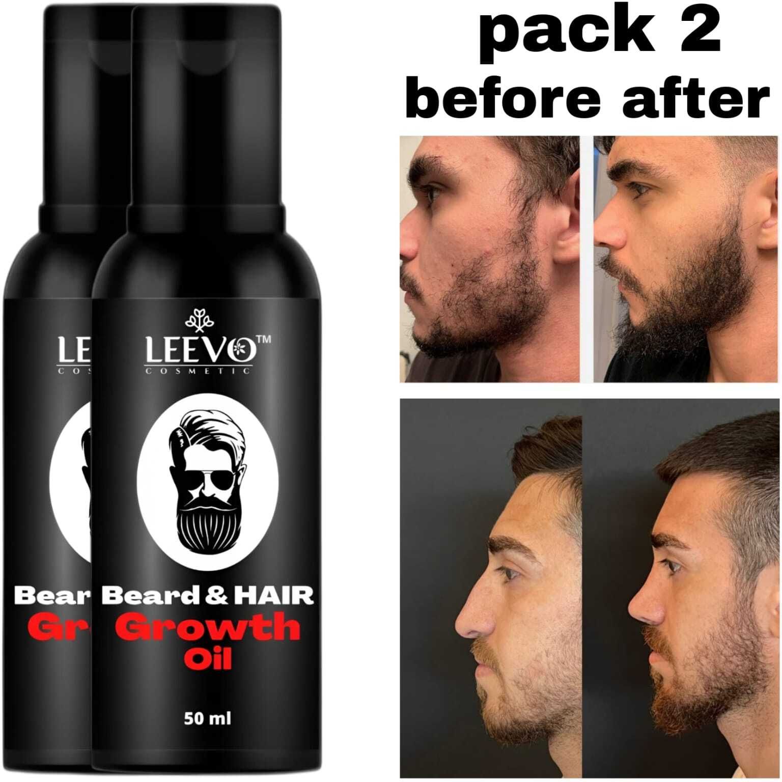 Premium Beard Oil for Beard Styling, Softness & Healthy Growth Hair Oil-image-32