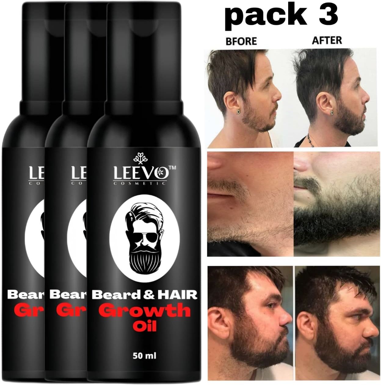 Natural Beard Growth Oil for Men with Essential Oils for Strong, Healthy Beard Hair Oil-image-25