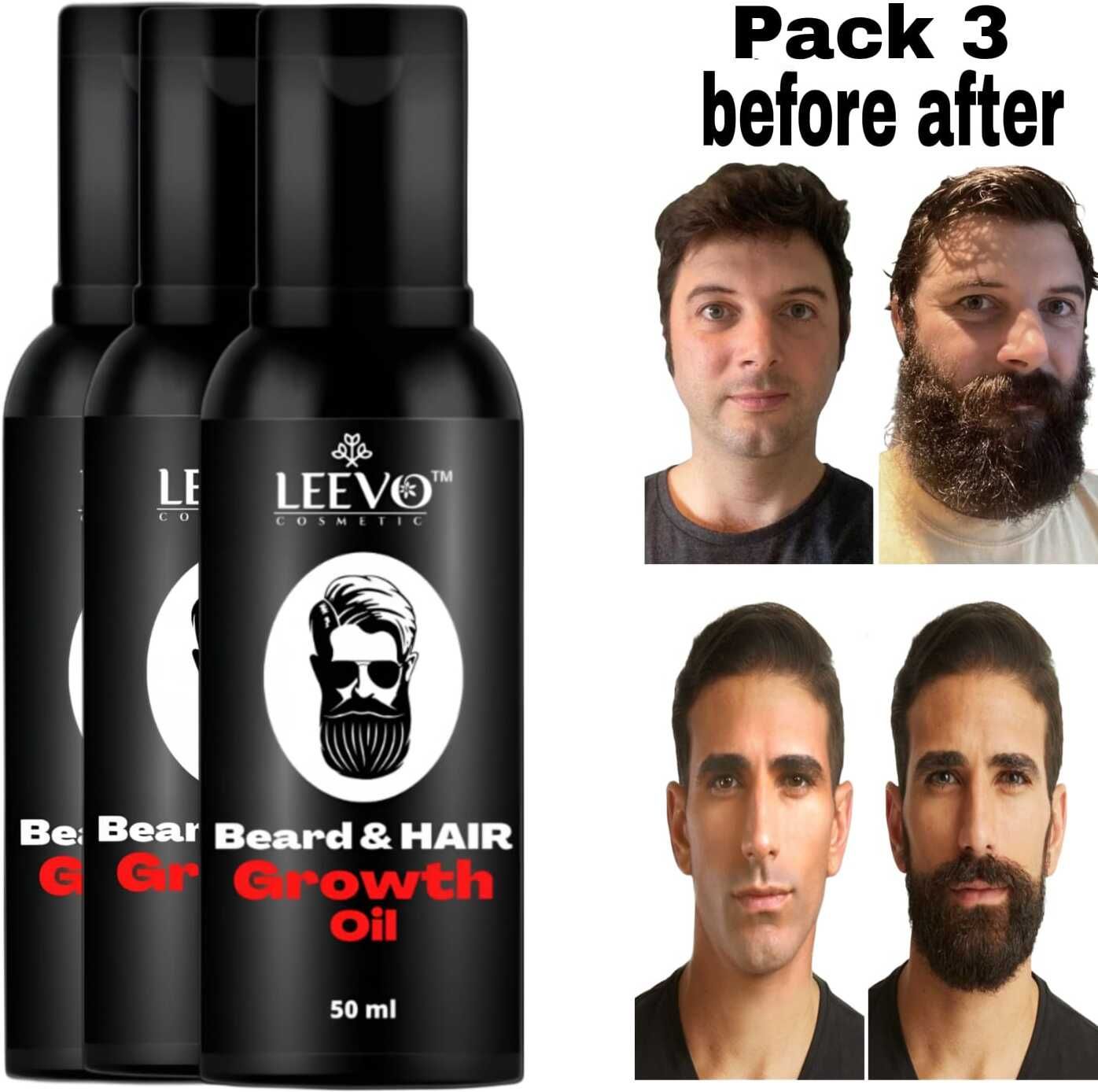 Beard Oil – Strong Roots & Fuller Beard Care Hair Oil-image-15