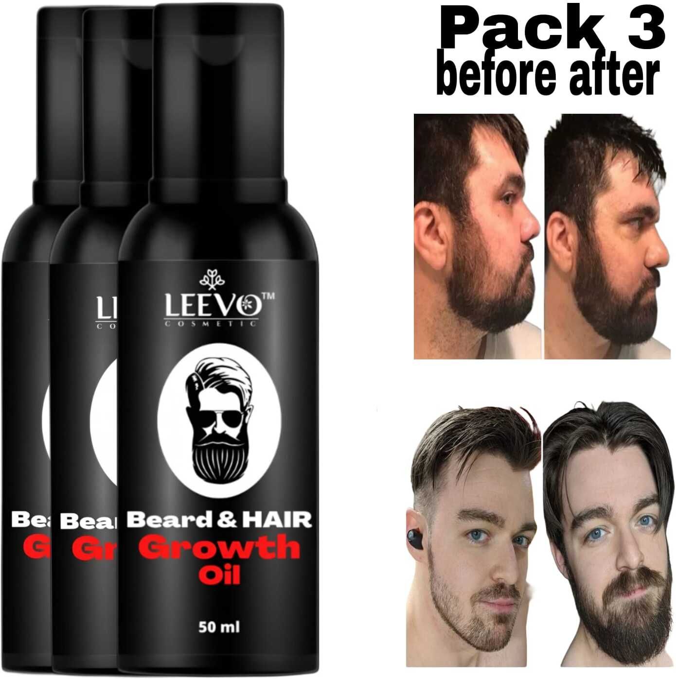 Beard Oil – Daily Nourishment for Modern Men Hair Oil-image-14