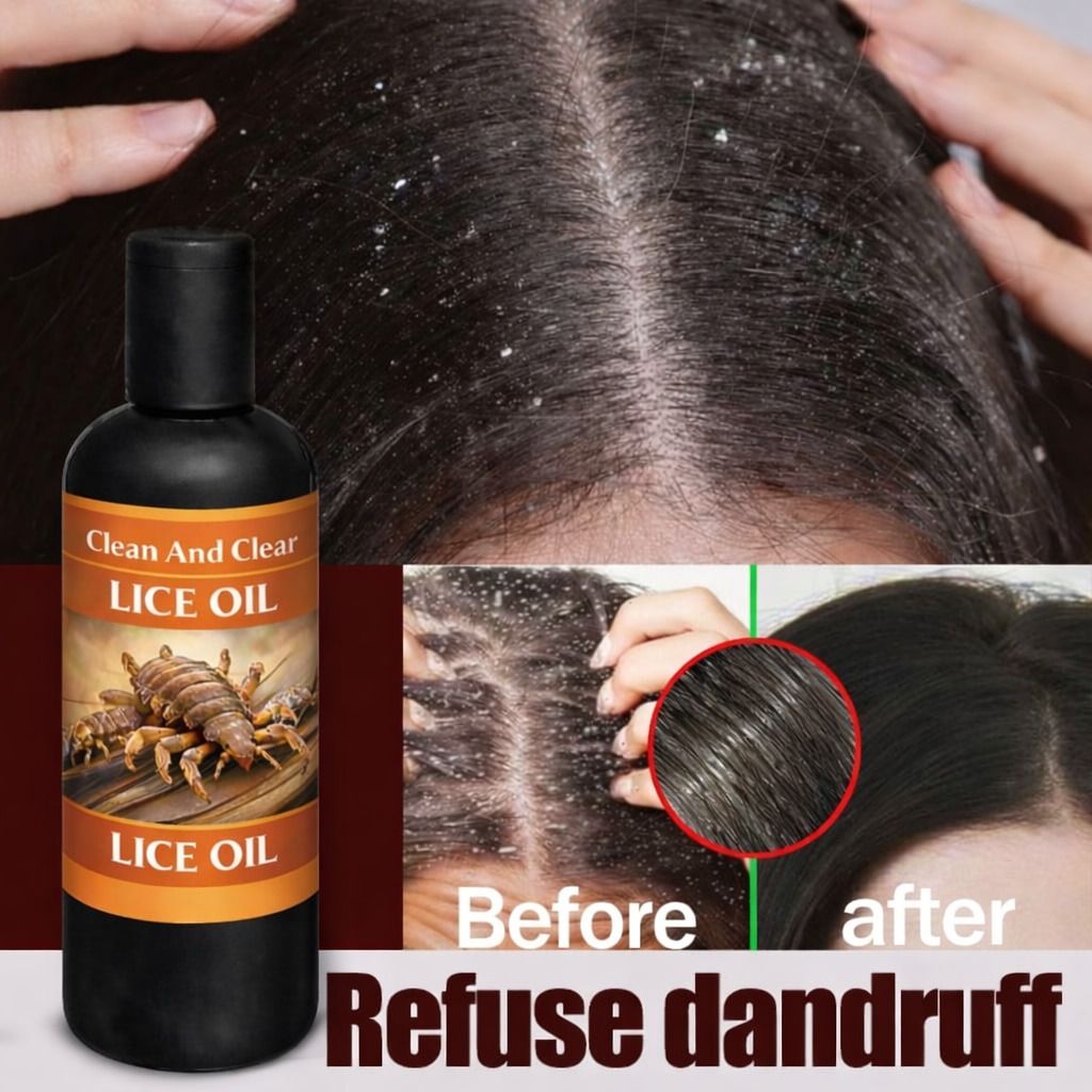 arialok LICE OIL Hair Oil-picture-3