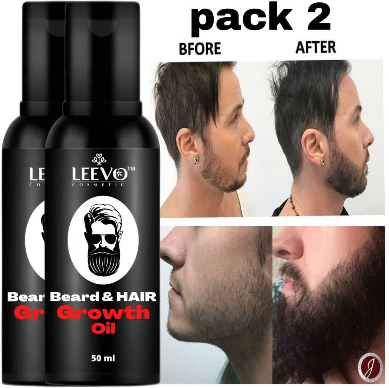 Beard Oil for Men for Faster Growth, Thickness, Softness & Itch-Free Beard Care Hair Oil-image-24