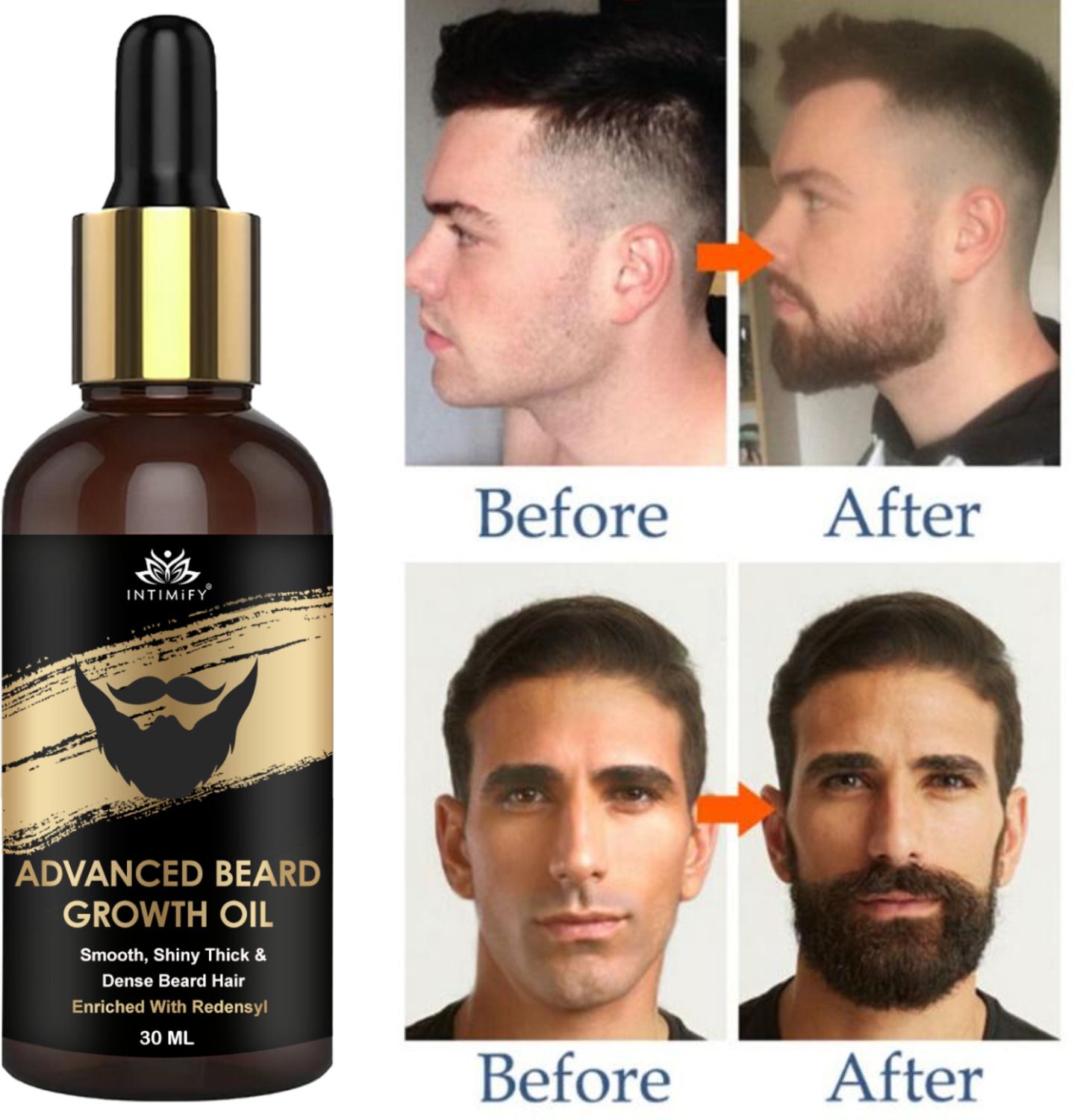 Advanced Beard Oil For faster beard growth | For thicker & fuller looking beard Hair Oil