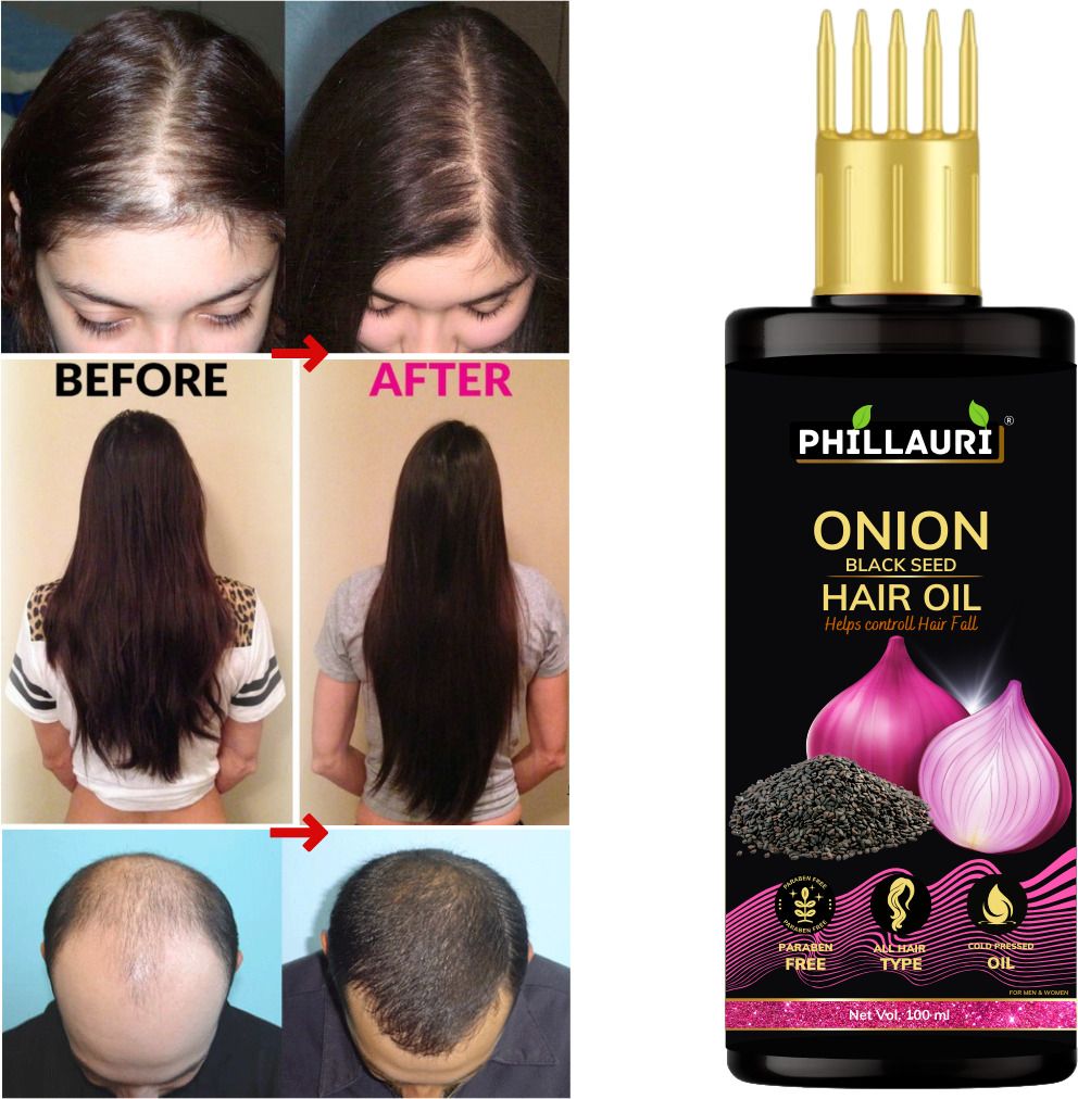 Onion Hair Oil With Black Seed Oil Extracts - Controls Hair Fall 100ml Hair Oil-image-2