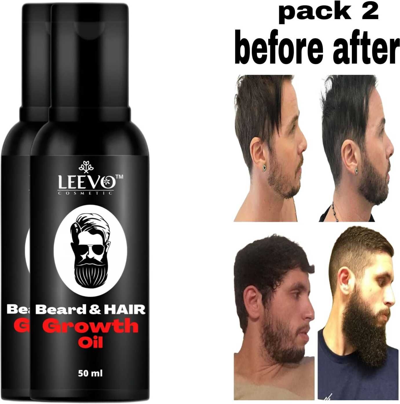 eard Boss Oil – Professional Grooming Solution Hair Oil-image-28
