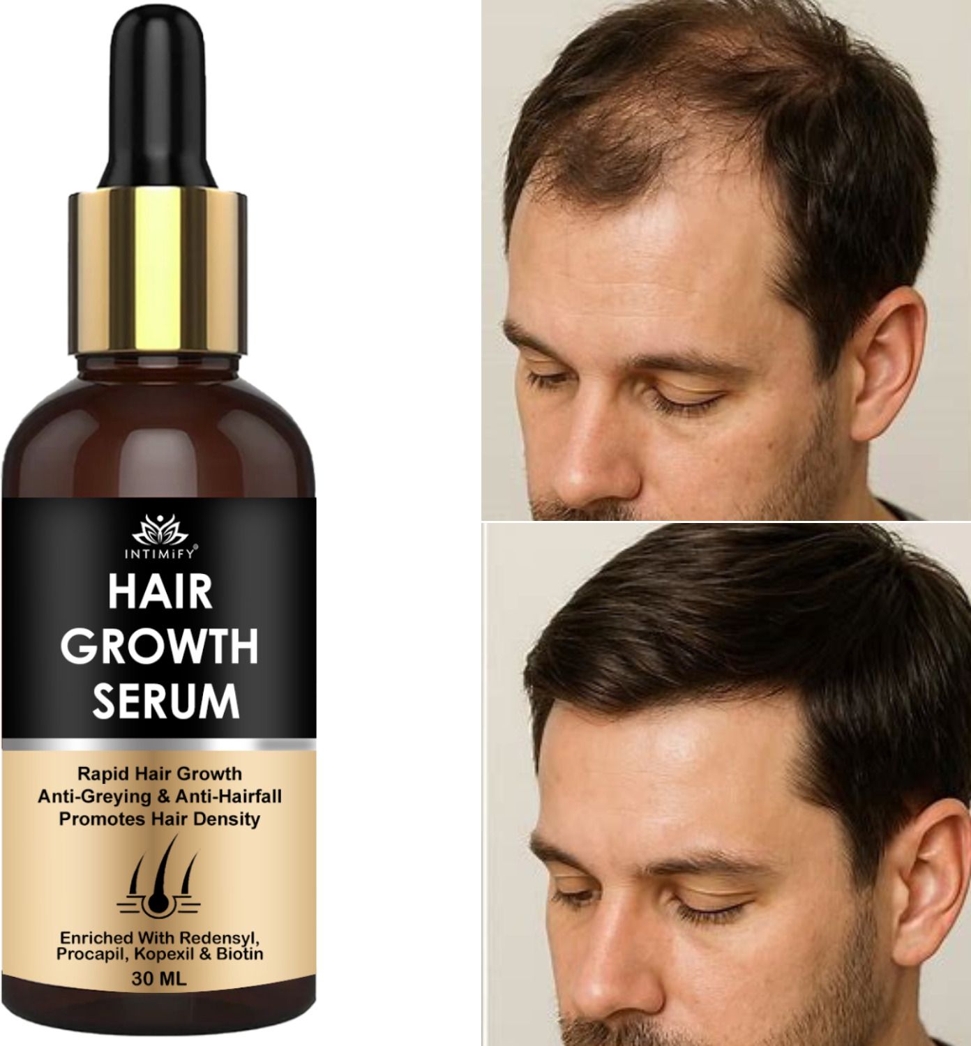 intimify Hair Growth Serum minimize hair fall, fostering healthier, fuller-looking hair-picture-2