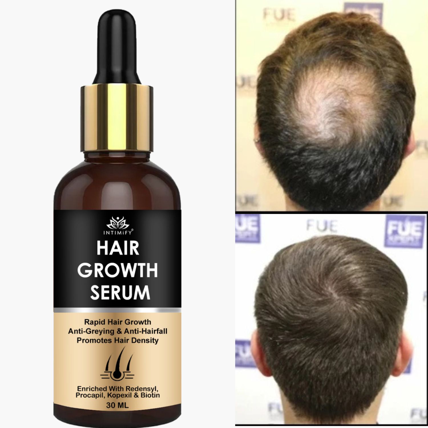 intimify Hair Growth Serum For Regrowth Strength & Thickness-picture-5