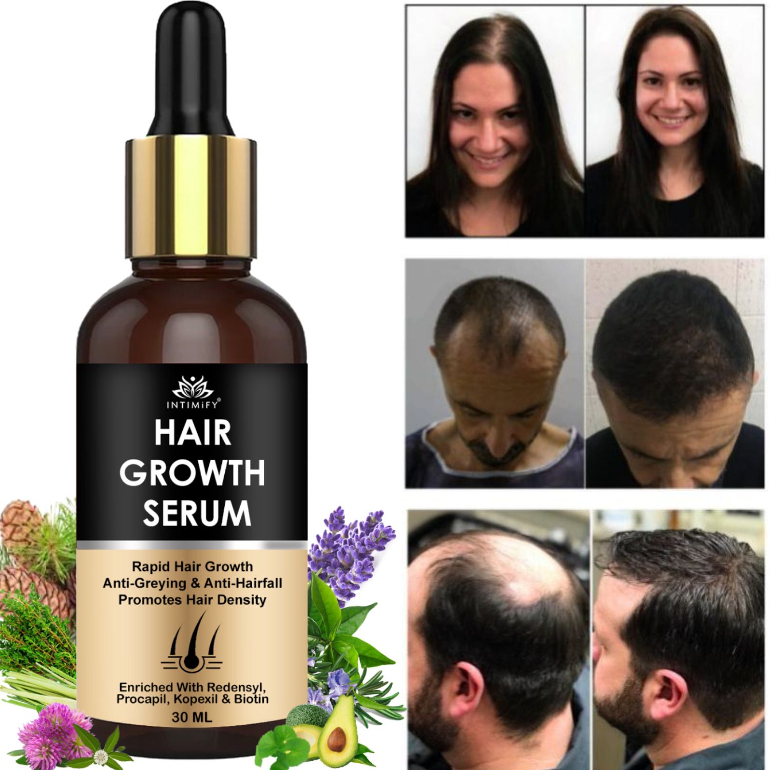 intimify Hair Growth Serum with Redensyl, Capixyl & Procapil For Women & Men-picture-7