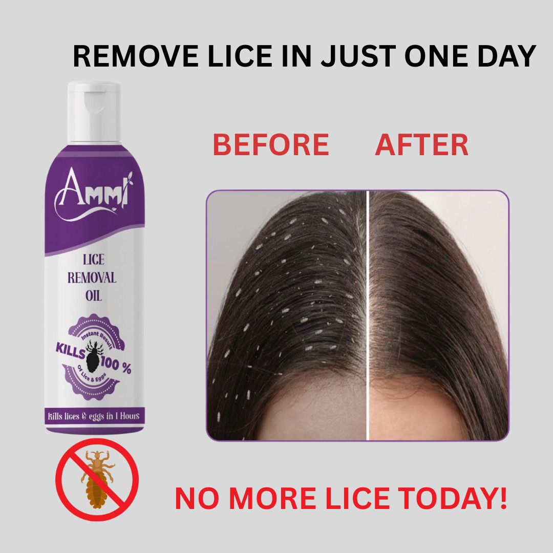 ammi Anti Lice Oil 100g | Herbal Formula | Scalp Care & Nit Removal-picture-19