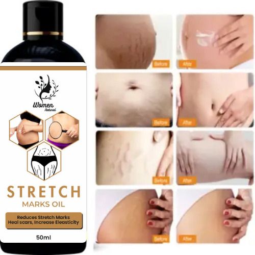 Stretch Marks Scar removal oil cream during after pregnancy-image-24