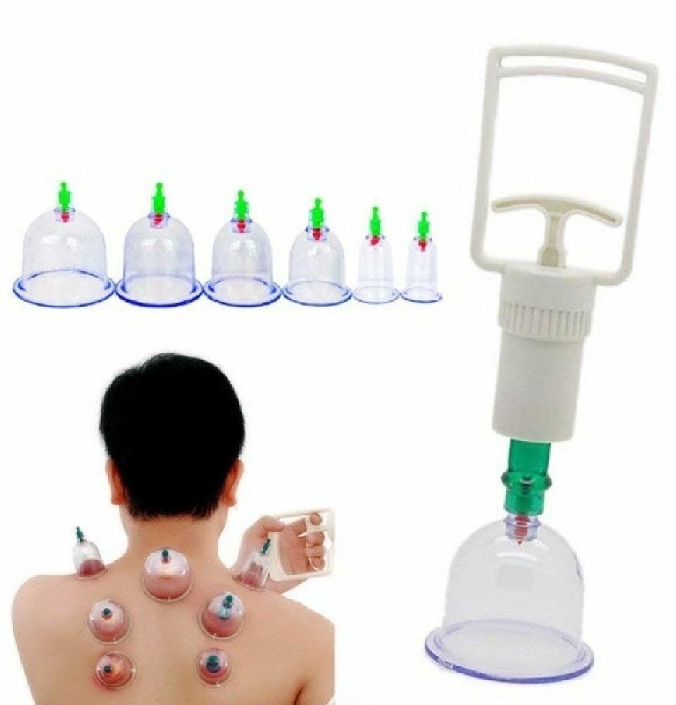 Birud Massage Cans Cups Cupping Kit Massager Body Suction Pumps Hijama Cupping Kit Set 6 Pcs Portable Body Relaxation Massage Manual Therapy Kit for Pain Relief Massager-image-3
