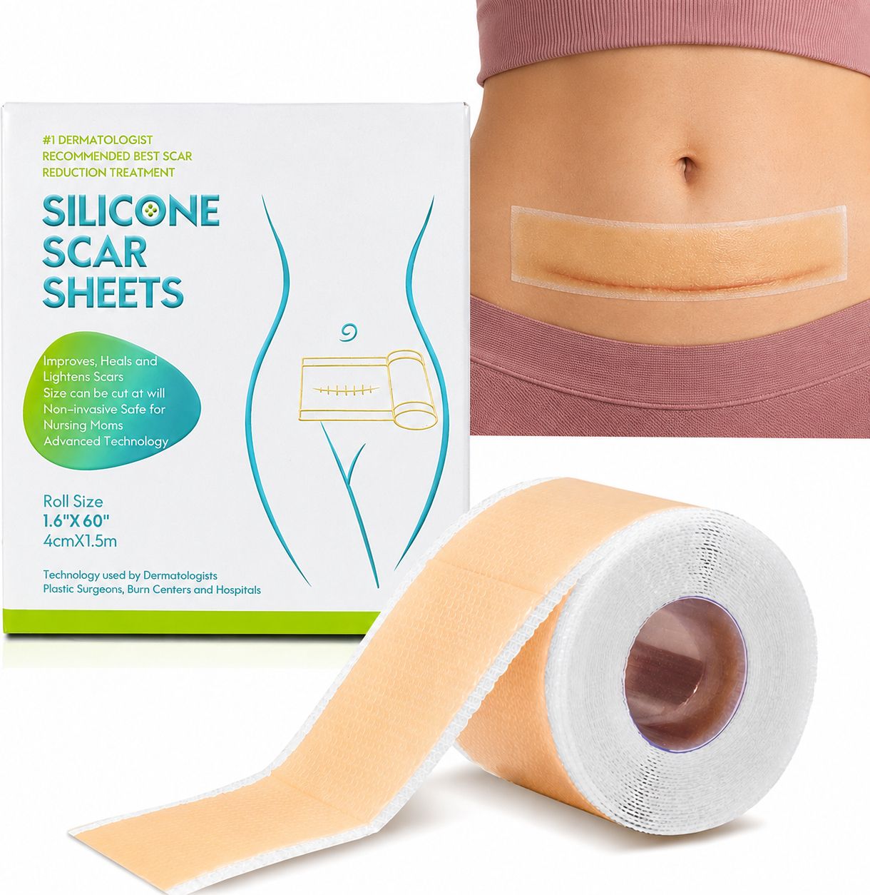Silicone Scar Treatment Sheet for Stretch Marks 4CM X 150CM Hydrocolloid Medical Dressing-image-5