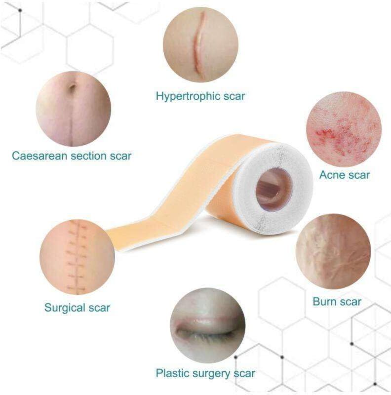 Silicone scar tape, Scar Removal Sheet Strips for C-Section_1 Gauze Medical Dressing