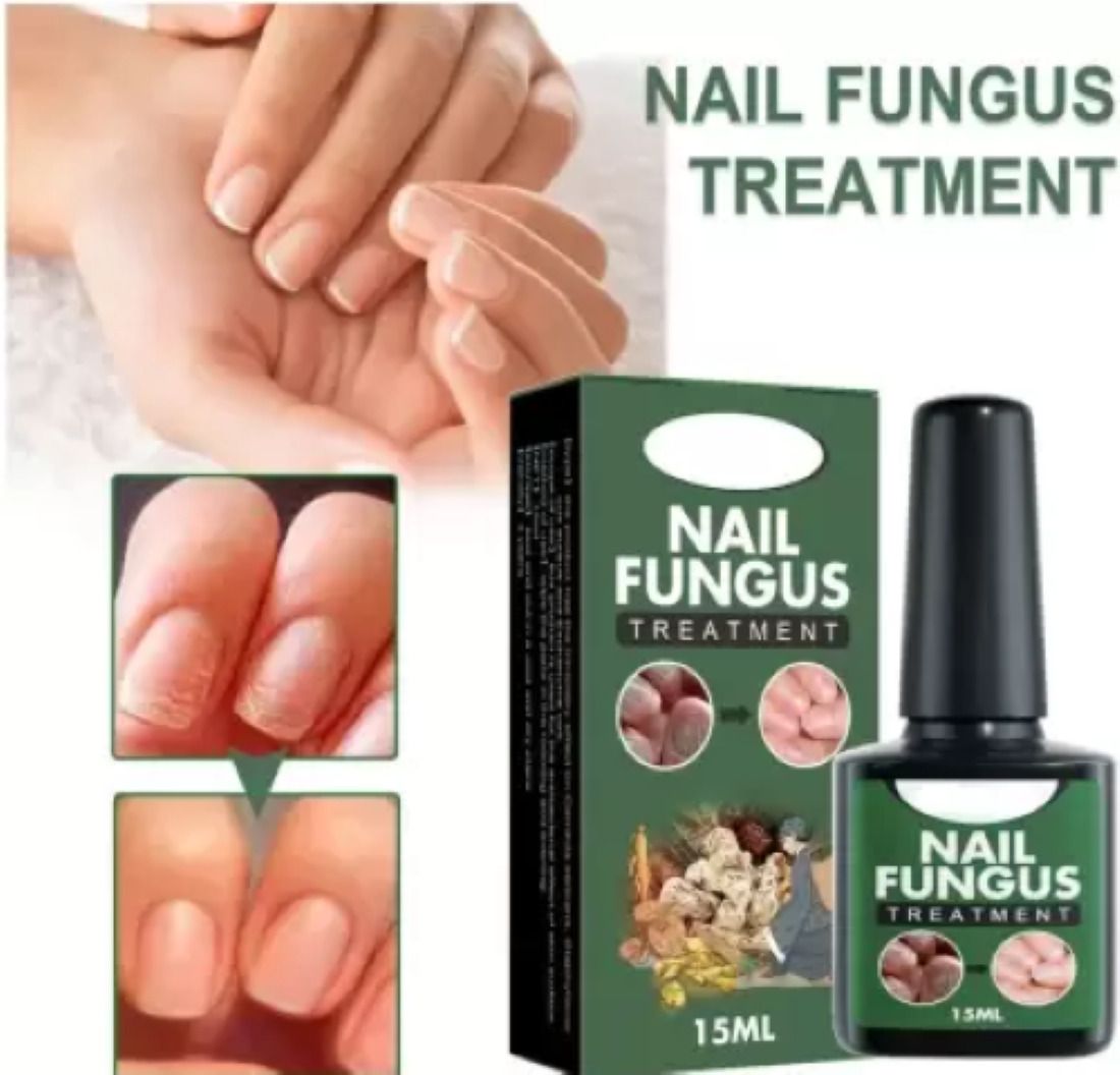 feelhigh Nail Fungus Treatment Repair Foot Removal Toe Fungal Infection Liquid for nails-picture-43