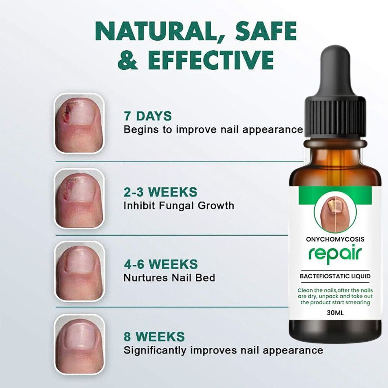motyl Nail Repair Treatment Foot Removal Toe Infection Liquid for nails Clear-picture-11