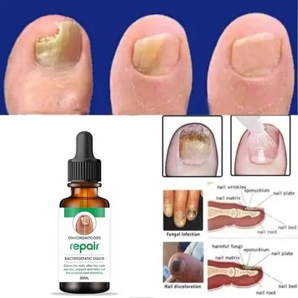 nail serum - nail repair serum - nail repair Brown