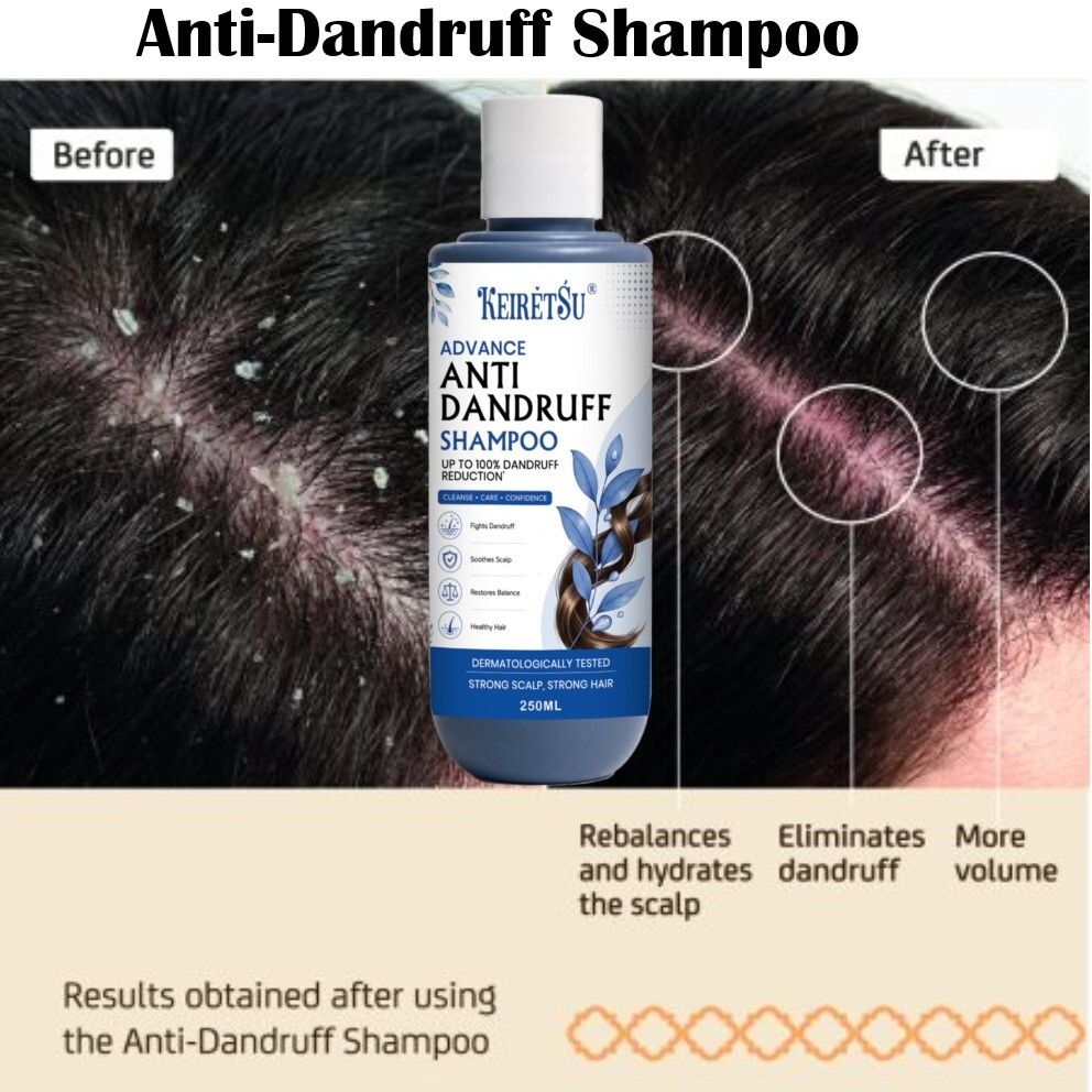 keiretsu Anti-Dandruff Shampoo Deep Cleansing 250 ml_19-picture-24