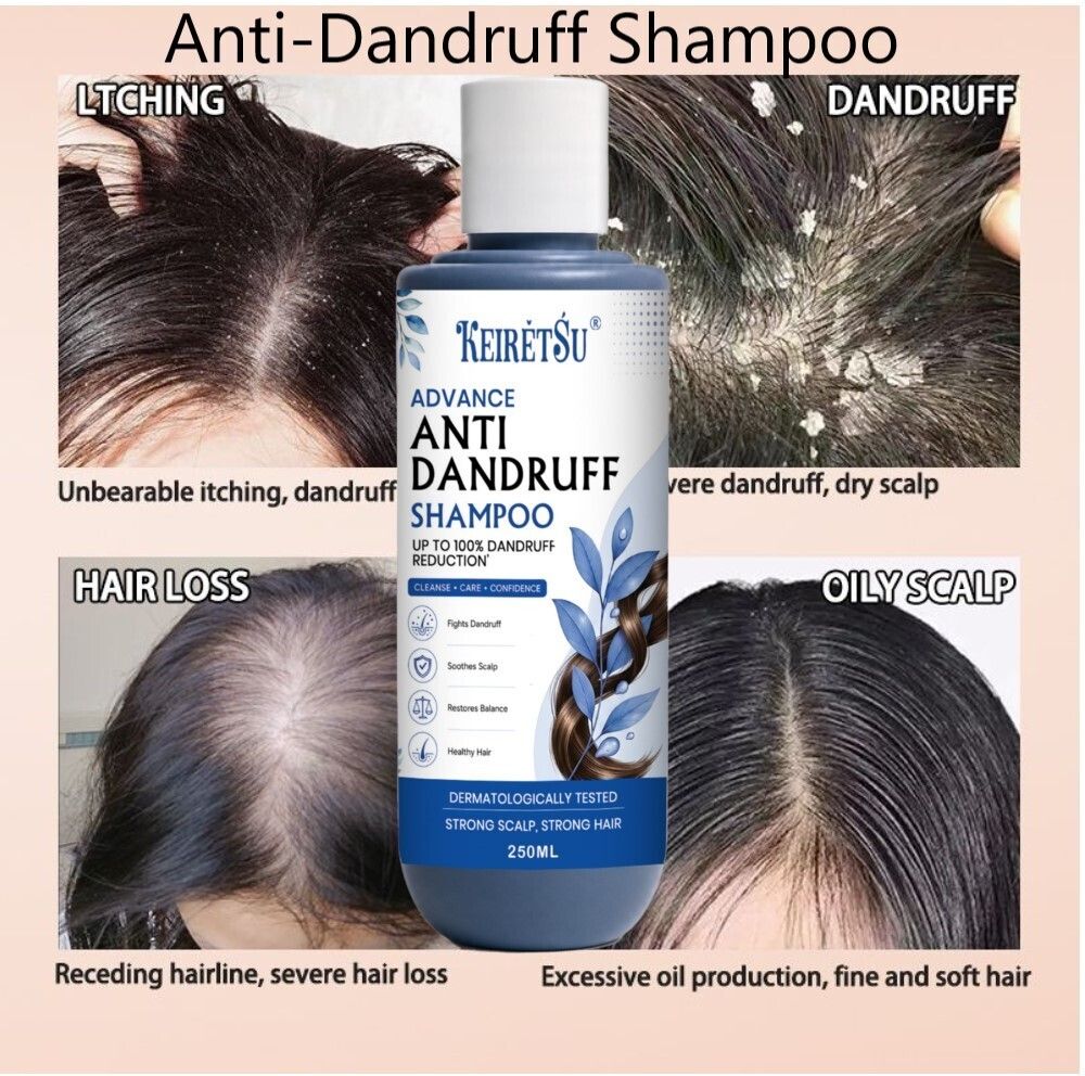 keiretsu Anti-Dandruff 250ml_6-picture-30