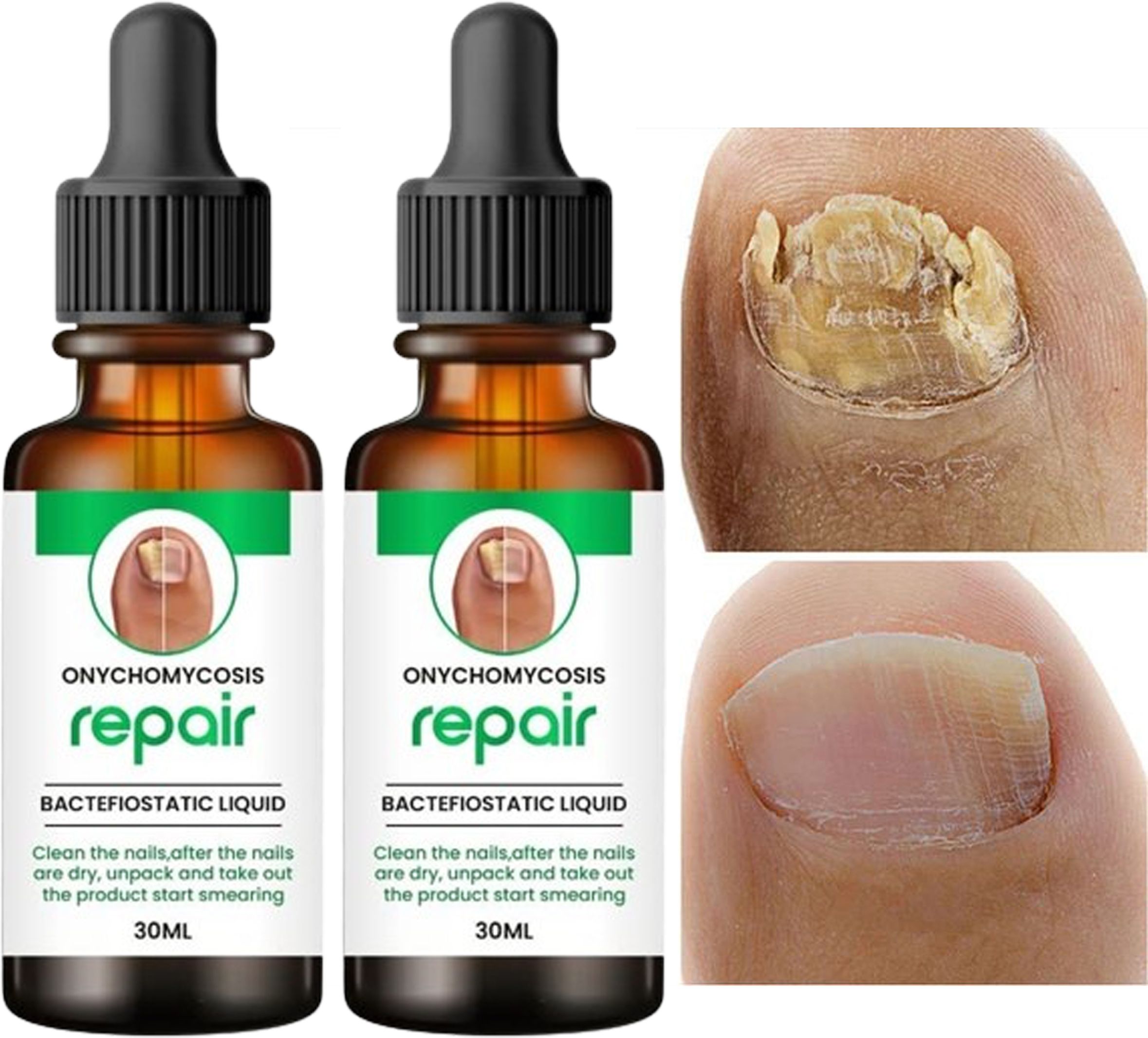 100% Natural Nails Strong Oil For Cuticle Care, Nail Growth & Strength Yellow