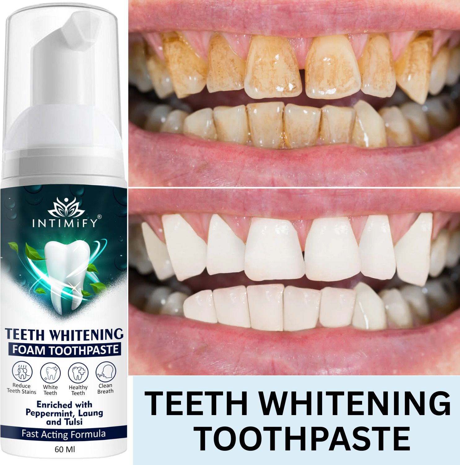 intimify teeth whitening foam, For A Radiant Smile & Strong Teeth Toothpaste-picture-28