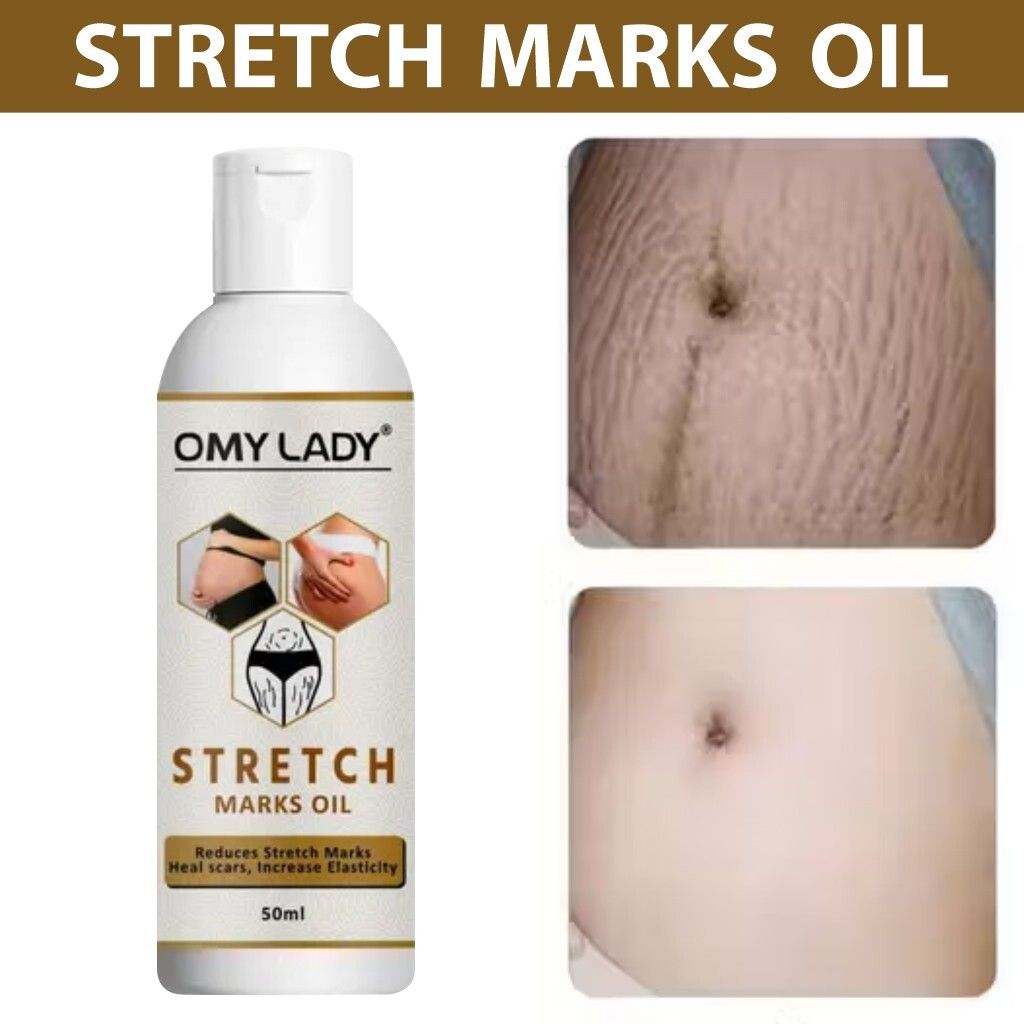 Omy Lady Nourishing Body Oil for Stretch Marks Reduction and Skin Repair-image-32