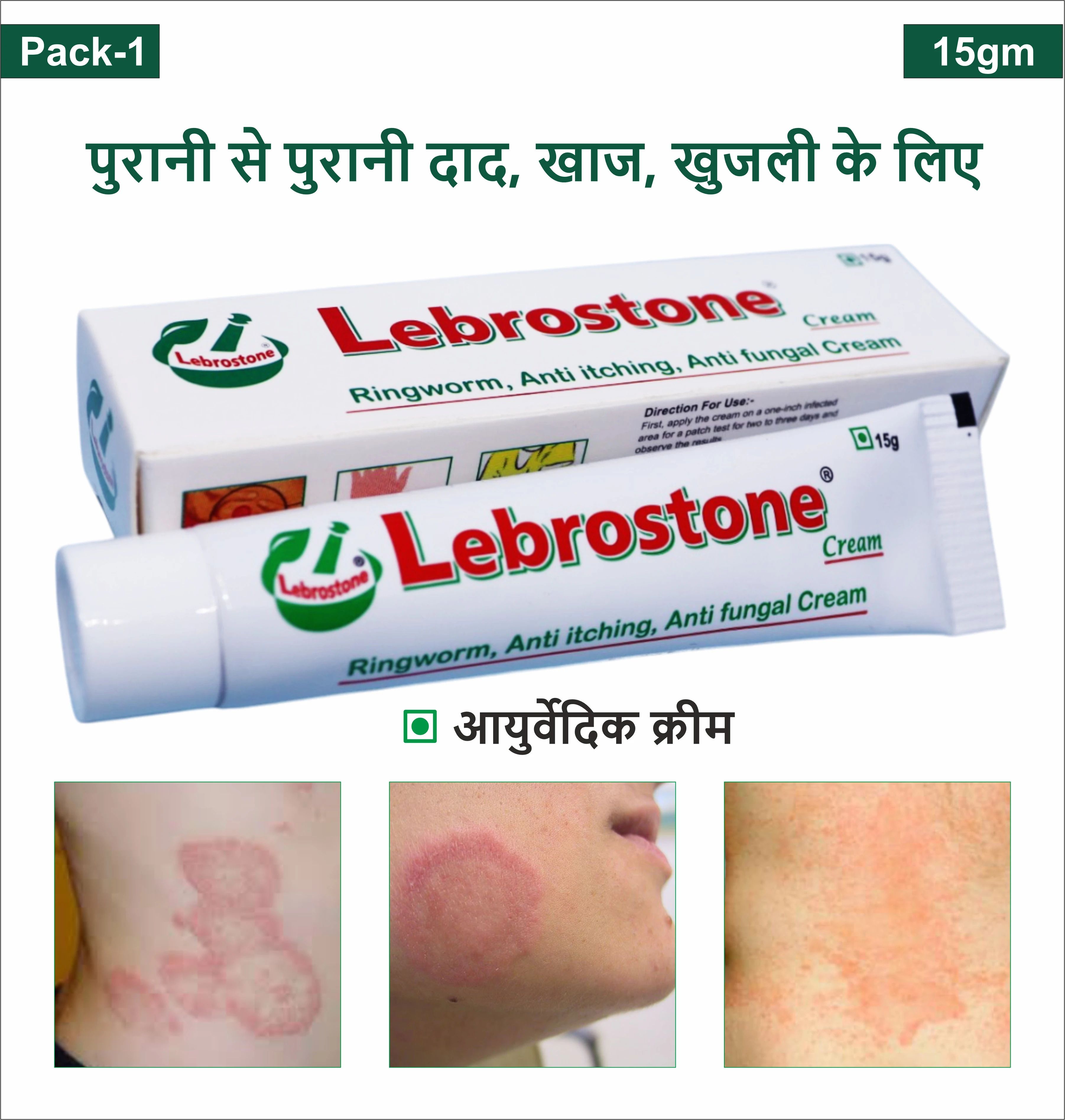Lebrostone Ayurvedic Skin Care Cream 15g Treatment for Ringworm, Anti Itching, & Anti Fungal Infections (Pack of 1)-image-20