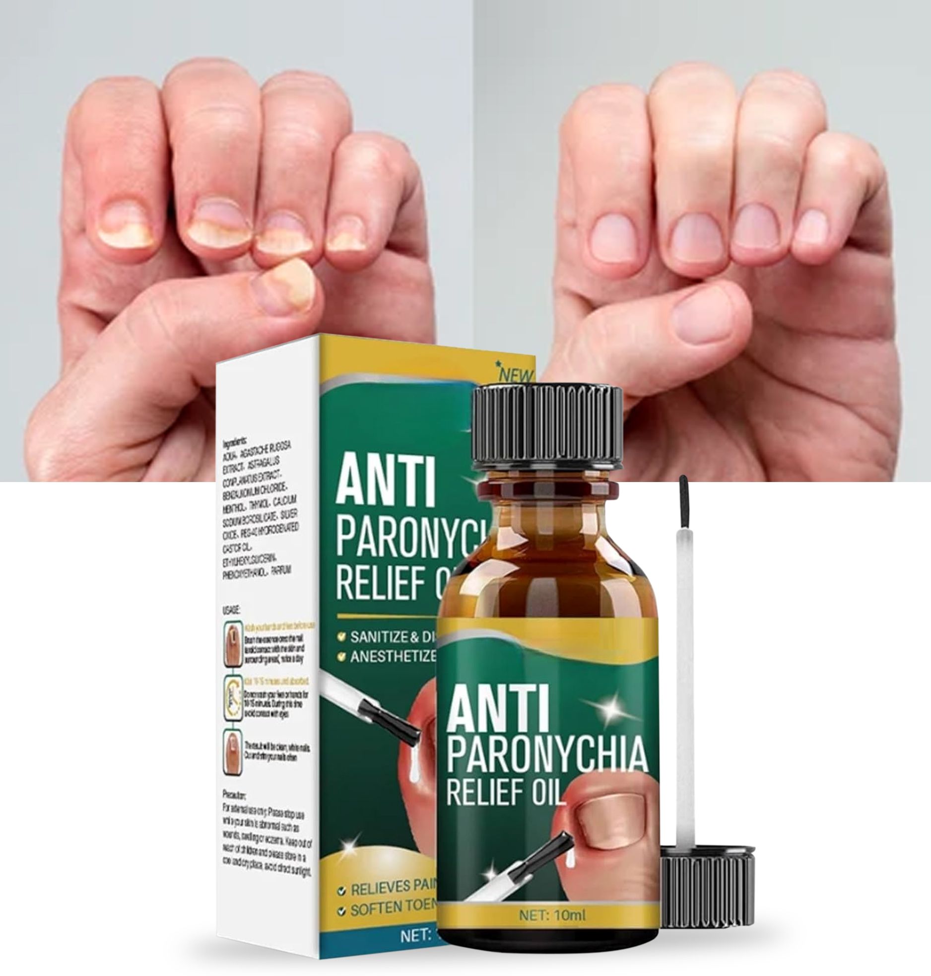 Anti Paronychia Nail Relief Oil Balanced Nail Anti Fungal Paronychia Repair Serum