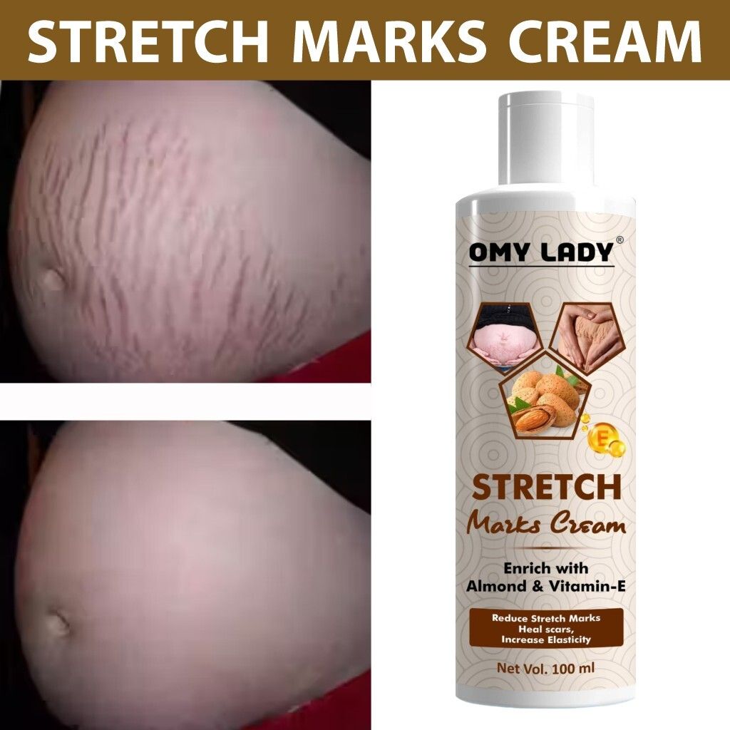 Omy Lady Nourishing Almond Oil and Vitamin E Cream for Stretch Marks-image-3